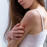 Signs and Symptoms of Eczema: What to Look For